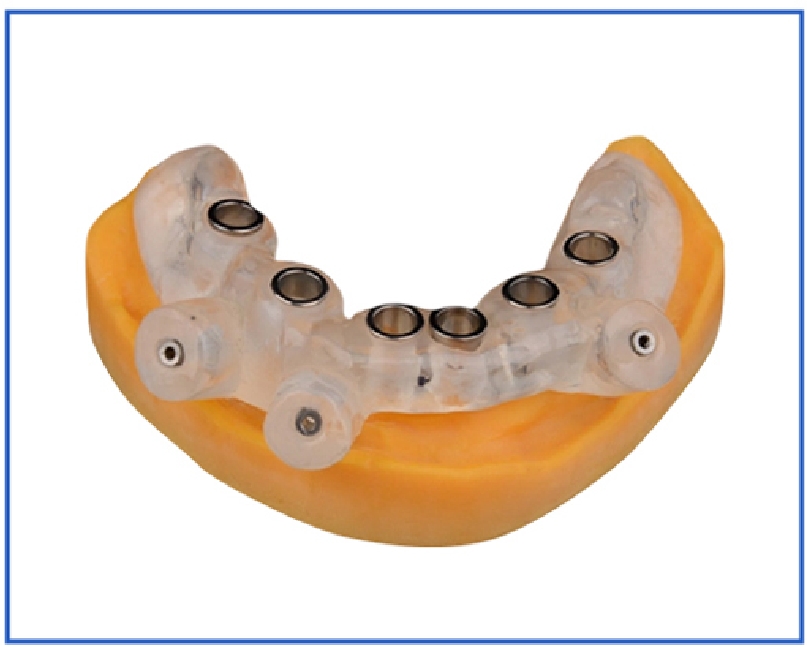 dental 3d printing solutions