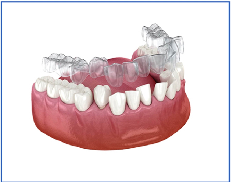dental 3d printing solutions