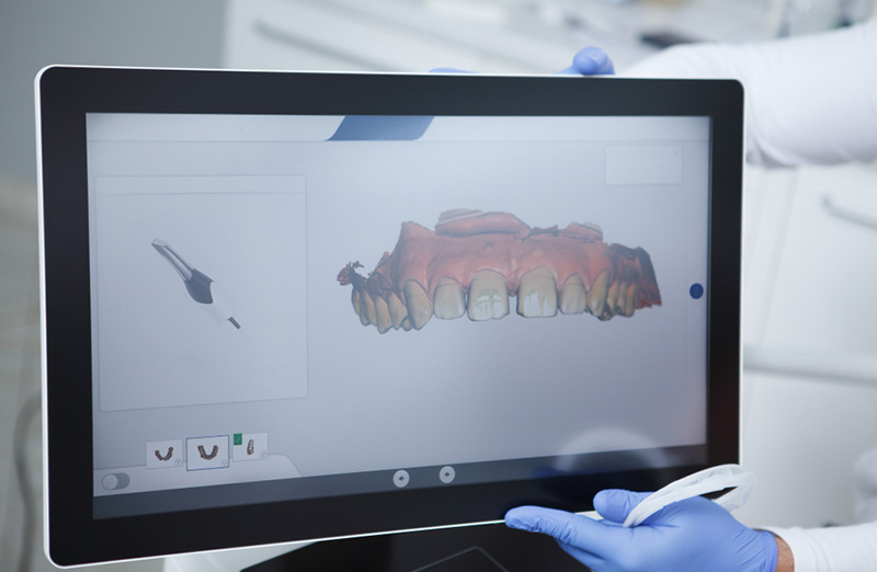 digital dental file