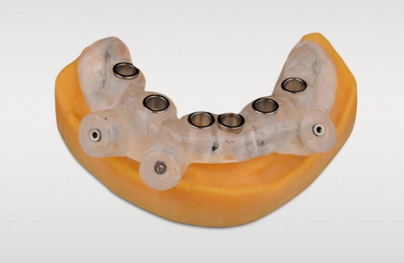 finished dental model after cleaning and uv curing