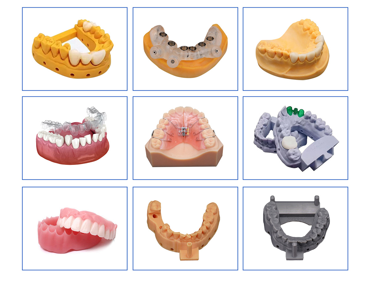 high precision dental resin printing for professional workflows