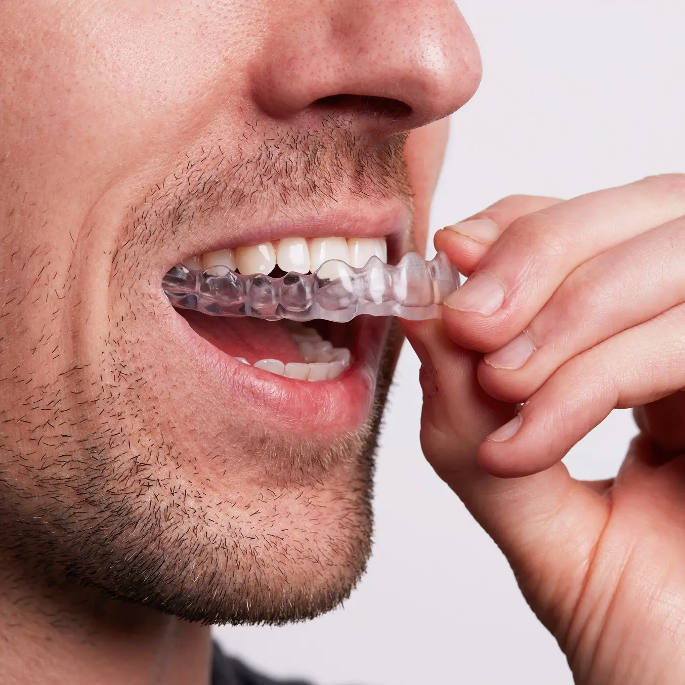 temporary dental applications